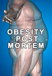 Watch Full Movie :Obesity: The Post Mortem (2016)